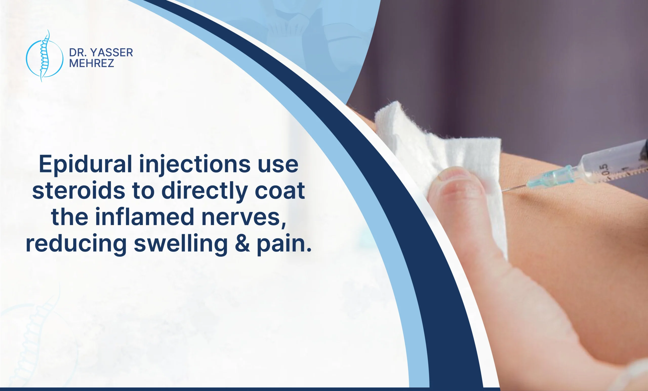 back pain and epidural injection