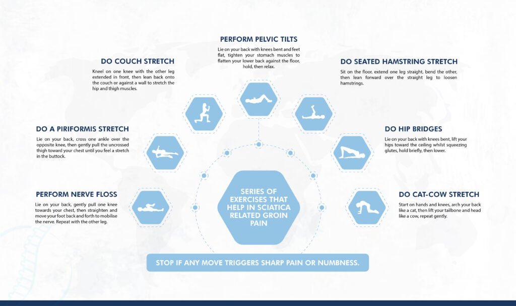 Exercises That Help in Sciatica-Related Groin Pain