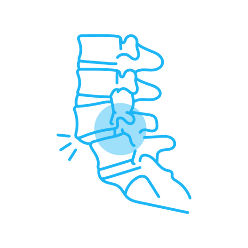Spondylolisthesis
